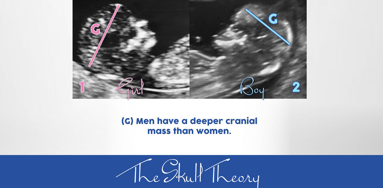 The Skull Theory The Physical Attributes Of Your Baby s Skull Matter the-skull-theory-the-physical-attributes-of-your-baby-s-skull-matter