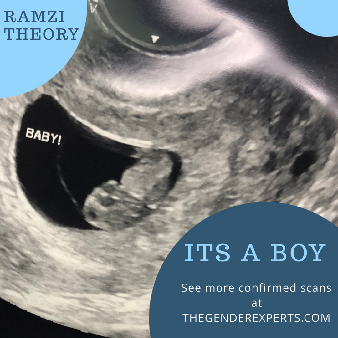 Early Gender Determination